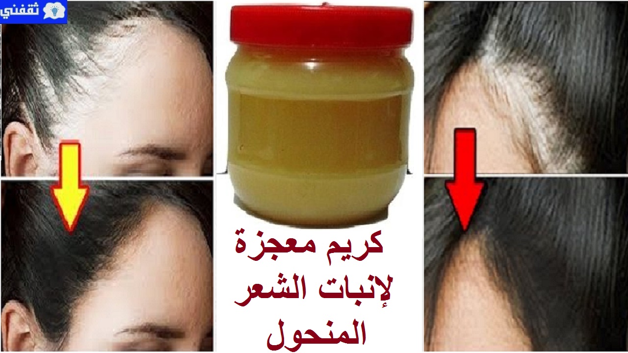 كنز رباني لإنبات فراغات الشعر المنحول في مقدمة الرأس وتكثيف الخصلات الجانبية