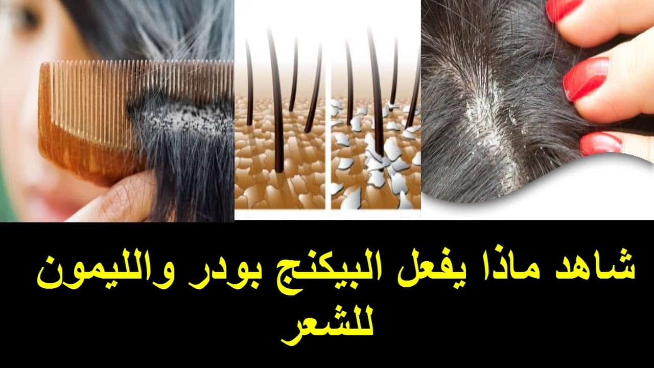كيف تتخلص من قشرة الشعر في خمس دقائق فقط وخلطة الزيوت السحرية لإطالة الشعر وإعادة إنباته في أسبوع