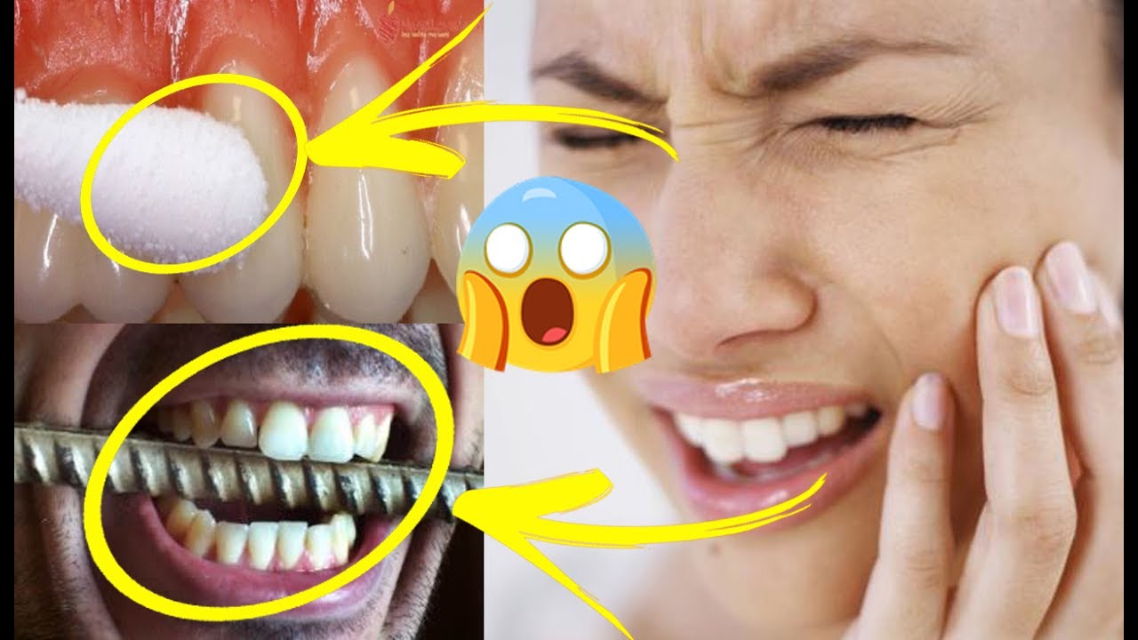 لكل من يعاني آلام الأسنان والتهاب اللثة بهذا المكون السحري تتخلصون من الالم في دقائق