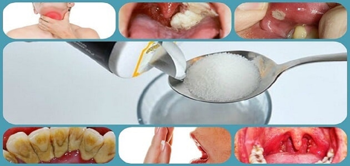 الملح أقوي طريقة لتبييض وتنظيف الاسنان وازالة الجير والاصفرار في ثواني