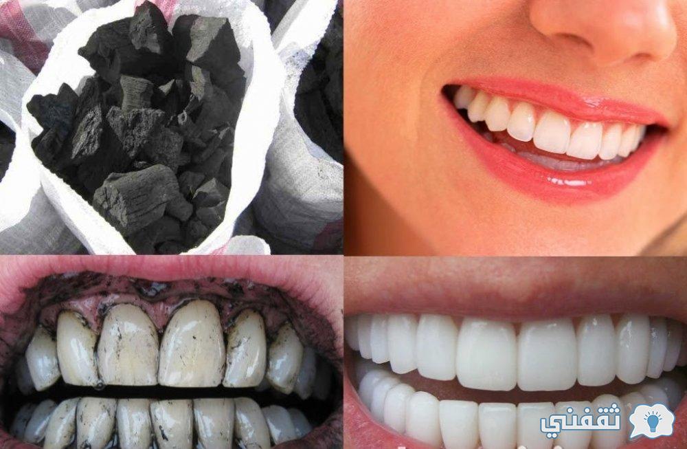 تبييض الأسنان بالفحم في وقت قياسي والتخلص من البقع الداكنة وتوحيد اللون فورًا