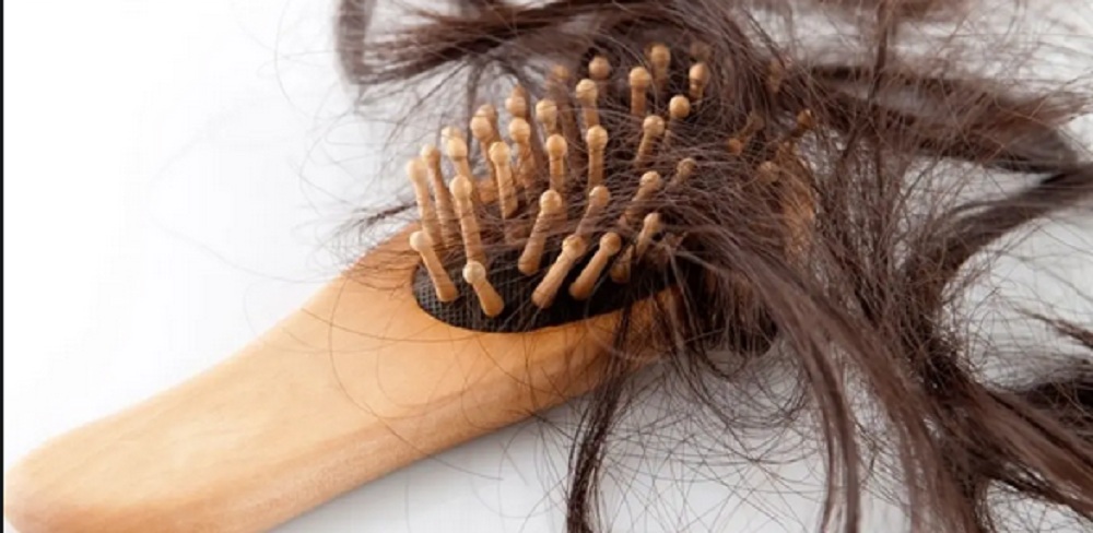 وصفة رائعة لعلاج تساقط الشعر من المنزل غير مكلفة