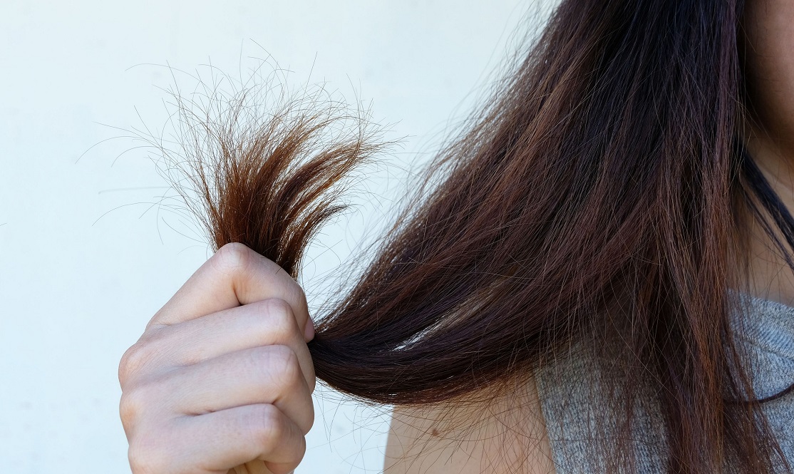 علاج تقصف الشعر بالوصفات الطبيعية وأفضل النصائح لتقليل التقصف