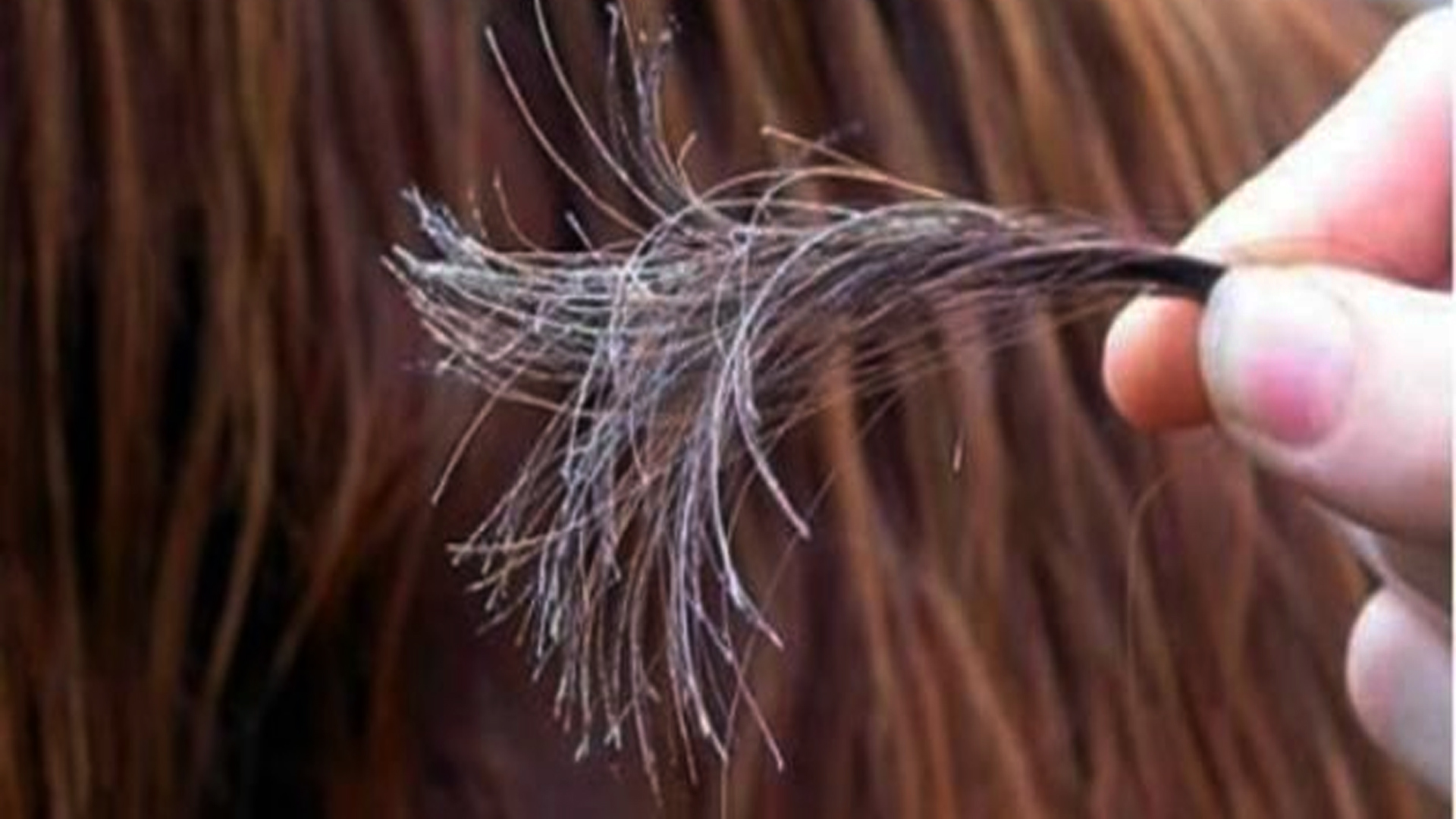 5 وصفات لاستخدام الصبار في ماساكات الشعر للتخلص من القشرة وتقوية شعرك وتنعيمه