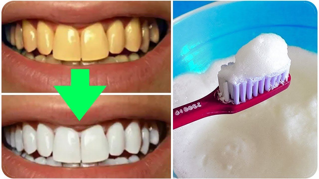 وفر نقودك.. تبييض الأسنان في 3 دقائق بوصفة منزلية سهلة لأسنان لامعة وبيضاء كالثلج بدون ليزر