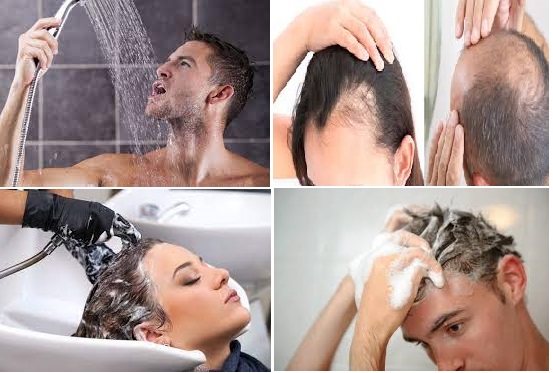 تحذير الأطباء من الاستحمام بهذه الطريقة حفاظا على الشعر ومنعه من التساقط