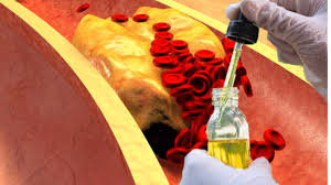 عصير يخفض الكولسترول ويحرق الدهون الثلاثية ويساعد في إنقاص الوزن ويطرد السموم من الجسم