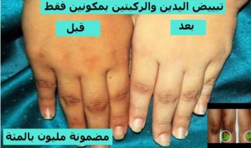 وصفة طبيعية لتفتيح اليدين بخلطات فعالة ومجربة