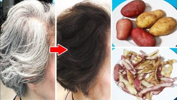 ‏فوائد قشور البطاطس وخصوصا في علاج شيب الشعر